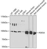 PDE5 Antibody in Western Blot (WB)