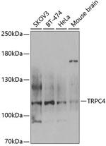 TRPC4 Antibody in Western Blot (WB)