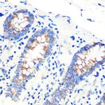 SCO2 Antibody in Immunohistochemistry (Paraffin) (IHC (P))