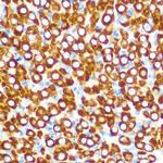 SCO2 Antibody in Immunohistochemistry (Paraffin) (IHC (P))