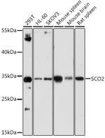 SCO2 Antibody in Western Blot (WB)