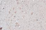 LC3B Antibody in Immunohistochemistry (Paraffin) (IHC (P))