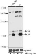 LC3B Antibody in Western Blot (WB)