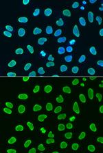 H4K8ac Antibody in Immunocytochemistry (ICC/IF)