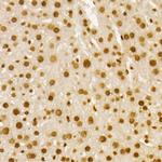 H4K8ac Antibody in Immunohistochemistry (Paraffin) (IHC (P))