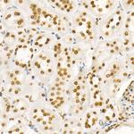 H4K8ac Antibody in Immunohistochemistry (Paraffin) (IHC (P))