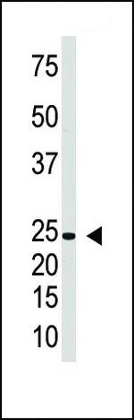 IL-29 Antibody in Western Blot (WB)