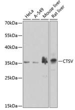 Cathepsin V Antibody in Western Blot (WB)