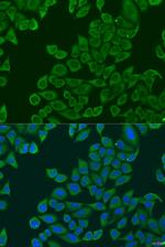 RPL36 Antibody in Immunocytochemistry (ICC/IF)