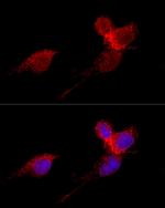 RPL36 Antibody in Immunocytochemistry (ICC/IF)