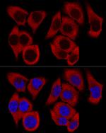 RPL36 Antibody in Immunocytochemistry (ICC/IF)