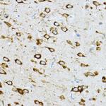 RPL36 Antibody in Immunohistochemistry (Paraffin) (IHC (P))