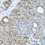 RPL36 Antibody in Immunohistochemistry (Paraffin) (IHC (P))