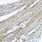 RPL36 Antibody in Immunohistochemistry (Paraffin) (IHC (P))