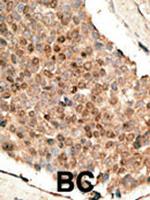 BMP-10 Antibody in Immunohistochemistry (Paraffin) (IHC (P))