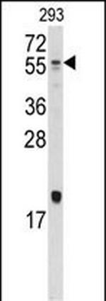 BMP-10 Antibody in Western Blot (WB)