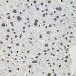 GTF2I Antibody in Immunohistochemistry (Paraffin) (IHC (P))