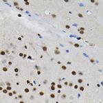 GTF2I Antibody in Immunohistochemistry (Paraffin) (IHC (P))