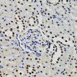 GTF2I Antibody in Immunohistochemistry (Paraffin) (IHC (P))