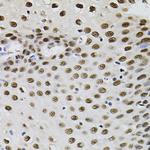 GTF2I Antibody in Immunohistochemistry (Paraffin) (IHC (P))