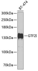 GTF2I Antibody in Western Blot (WB)