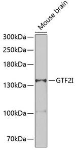 GTF2I Antibody in Western Blot (WB)