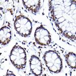 SAFB Antibody in Immunohistochemistry (Paraffin) (IHC (P))