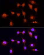 KPNA3 Antibody in Immunocytochemistry (ICC/IF)