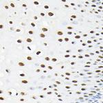 KPNA3 Antibody in Immunohistochemistry (Paraffin) (IHC (P))