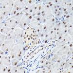 KPNA3 Antibody in Immunohistochemistry (Paraffin) (IHC (P))