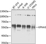 KPNA3 Antibody in Western Blot (WB)