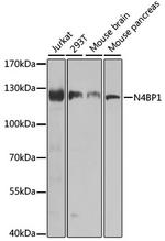 N4BP1 Antibody in Western Blot (WB)