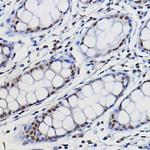 METTL14 Antibody in Immunohistochemistry (Paraffin) (IHC (P))