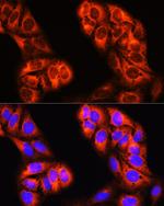 MTHFD1 Antibody in Immunocytochemistry (ICC/IF)