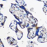 EYA1 Antibody in Immunohistochemistry (Paraffin) (IHC (P))