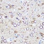 EYA1 Antibody in Immunohistochemistry (Paraffin) (IHC (P))