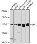 EYA1 Antibody in Western Blot (WB)