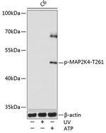 Phospho-MAP2K4 (Thr261) Antibody in Western Blot (WB)