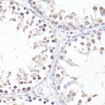 Phospho-c-Myc (Thr58) Antibody in Immunohistochemistry (Paraffin) (IHC (P))