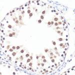 Phospho-c-Myc (Ser62) Antibody in Immunohistochemistry (Paraffin) (IHC (P))