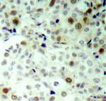 Phospho-CDK2 (Thr160) Antibody in Immunohistochemistry (Paraffin) (IHC (P))