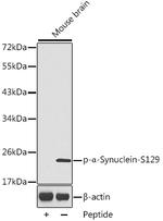 Phospho-alpha Synuclein (Ser129) Antibody in Western Blot (WB)