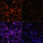 Phospho-Zap-70 (Tyr493) Antibody in Immunocytochemistry (ICC/IF)