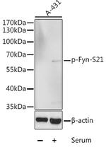 Phospho-Fyn (Ser21) Antibody in Western Blot (WB)