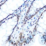 Phospho-IRS1 (Ser612) Antibody in Immunohistochemistry (Paraffin) (IHC (P))