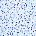 Phospho-IRS1 (Ser612) Antibody in Immunohistochemistry (Paraffin) (IHC (P))