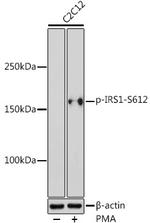 Phospho-IRS1 (Ser612) Antibody in Western Blot (WB)