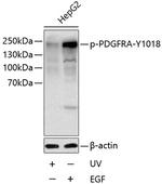 Phospho-PDGFRA (Tyr1018) Antibody in Western Blot (WB)