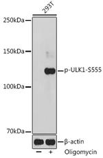 Phospho-ULK1 (Ser555) Antibody in Western Blot (WB)