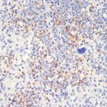 Phospho-PLCG2 (Tyr1217) Antibody in Immunohistochemistry (Paraffin) (IHC (P))